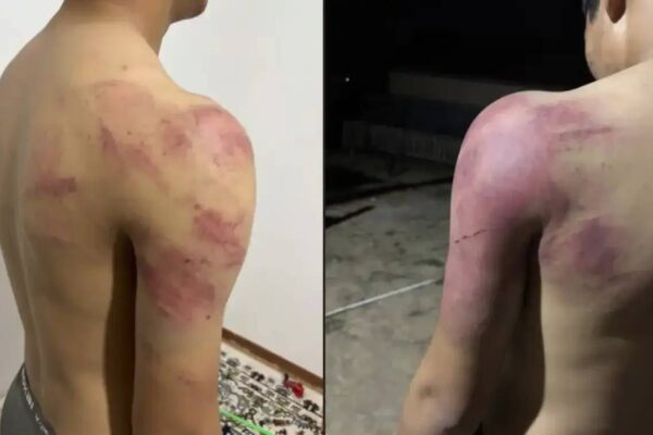 Атырауда жасөспірімді аяусыз соққыға жыққандар ұсталды